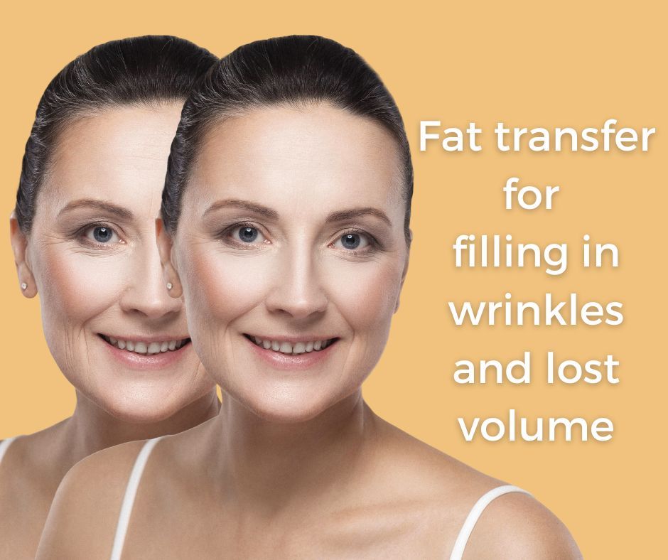 Skin Tighten fat transfer face