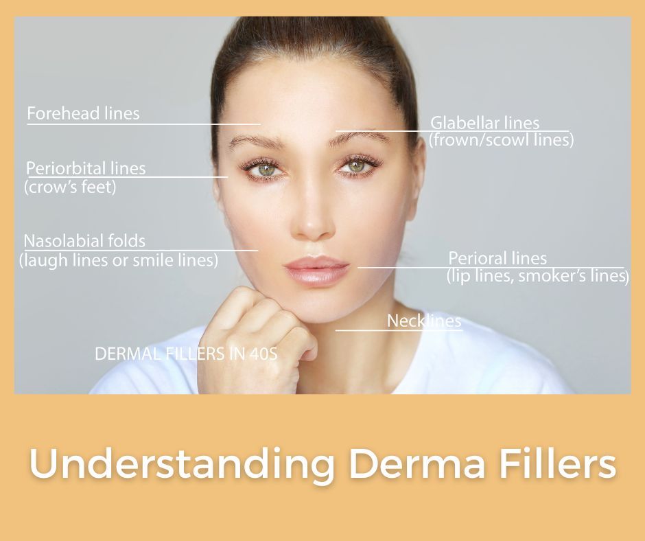 Benefits of Dermal Fillers