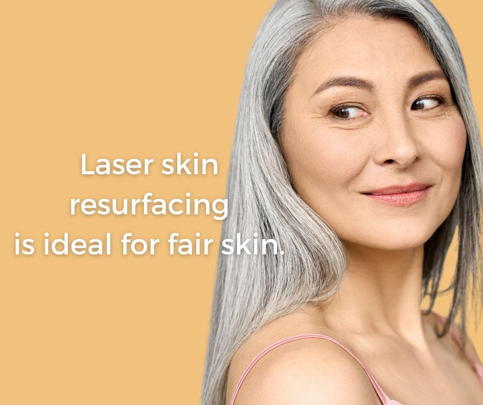 Laser resurfacing for fair skin