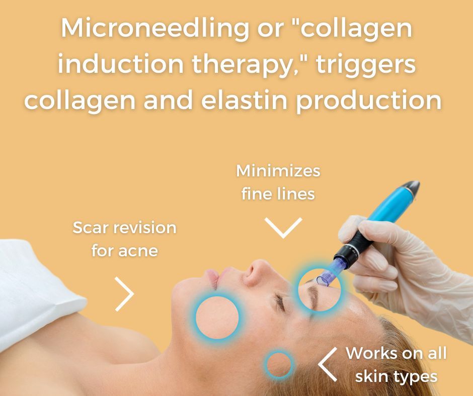 Skin tightening centers microneedling